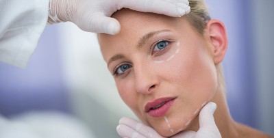 Tratamiento de hilos tensores en el rostro de una joven mujer